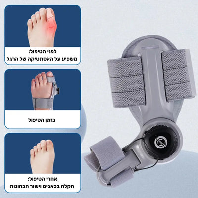 פיור קומפורט פוט אליינר – סד אורטופדי לתיקון והקלה על בוניונים