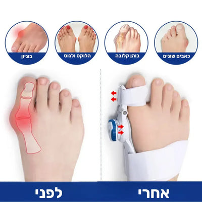 פיור קומפורט איזי-פוט – סד אורטופדי חכם להפחתת כאבים בבוהן